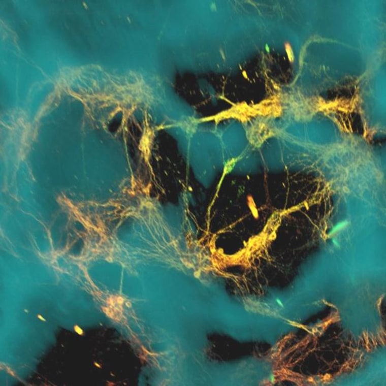 Image: Neurons in brainlike tissue