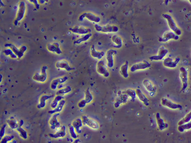 Image: Naegleria fowleri