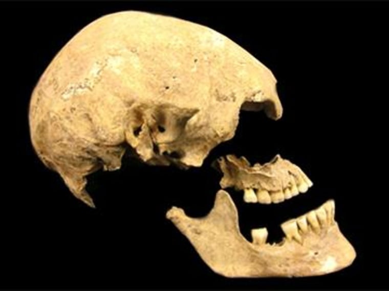 Image: Ancient skull