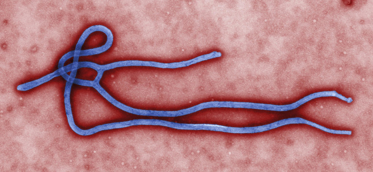 Image: Some of the ultrastructural morphology displayed by an Ebola virus virion is revealed in this undated handout colorized transmission electron micrograph