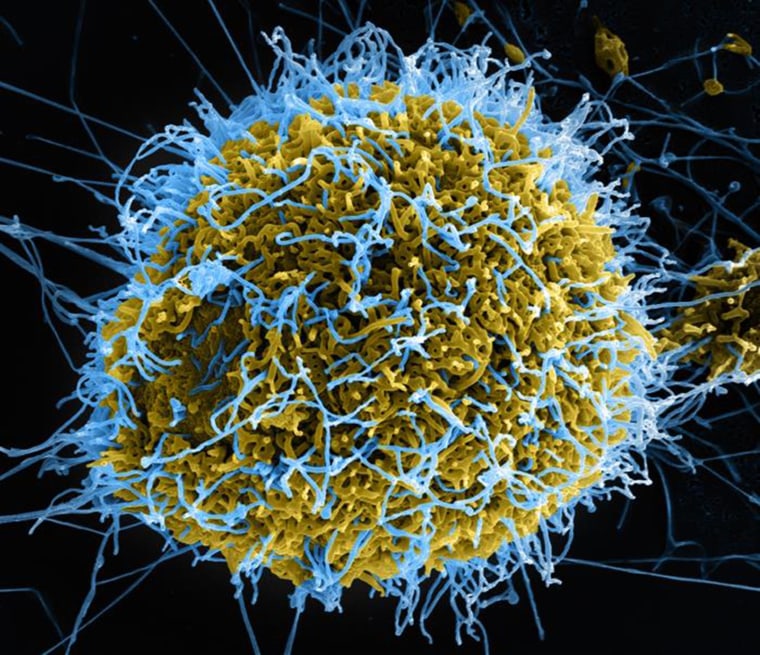 Image: Numerous filamentous Ebola virus particles (blue) budding from a chronically-infected VERO E6 cell (yellow-green)