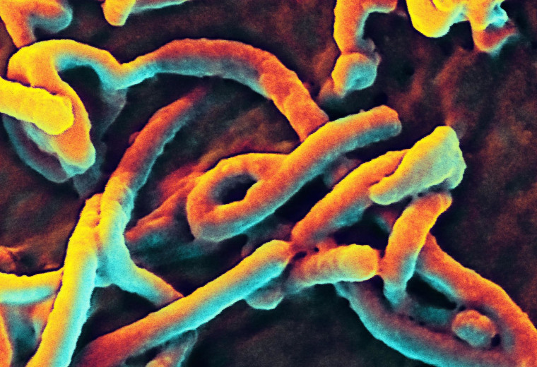 An image provided by the National Institute of Allergy and Infectious Diseases shows a scanning electron micrograph of Ebola virus budding from the surface of a Vero cell of an African green monkey kidney epithelial cell line.  