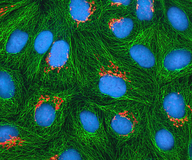 A multiphoton fluorescence image shows cultured HeLa cancer cells with a fluorescent protein targeted to the Golgi apparatus (orange), microtubules (green) and counterstained for DNA (cyan). The work was funded by the National Institutes of Health at the National Center for Microscopy and Imaging Research.