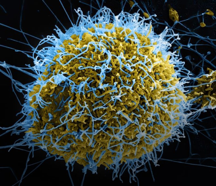 Image: Numerous filamentous Ebola virus particles (blue) budding from a chronically-infected VERO E6 cell (yellow-green).