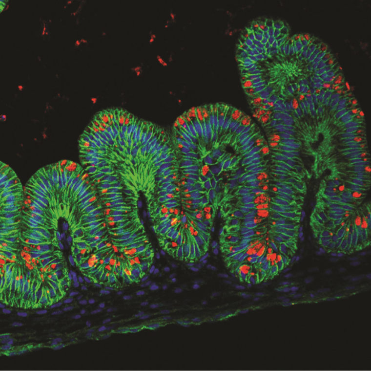 Image: Immunofluorescent image of human stomach tissue