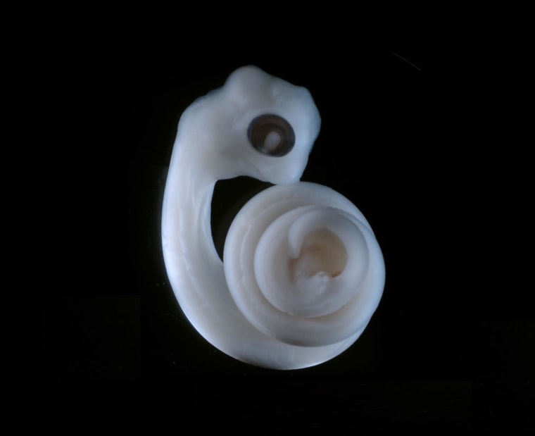 Image: Python embryo