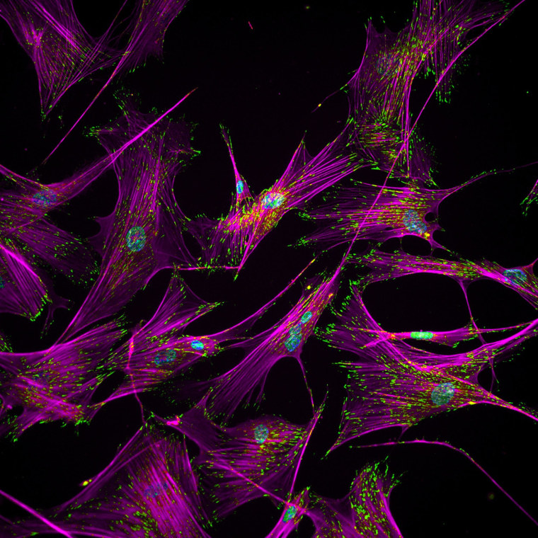 Image: Fibroblast cells