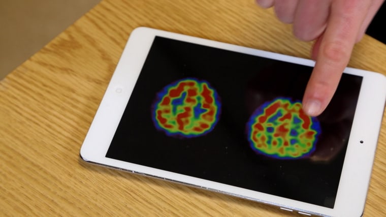 An iPad displays different radioactive dyes that help map brain activity.