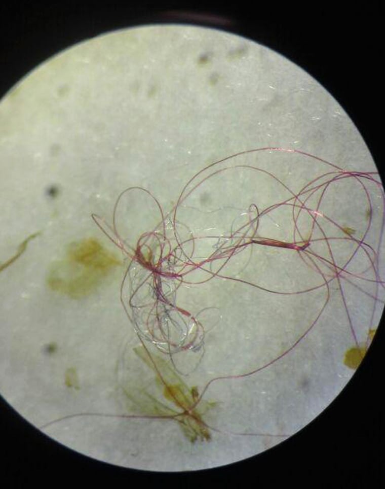 Image: Microfibers, exceedingly fine plastic fibers, that were taken from inside the body of a Great Lakes fish