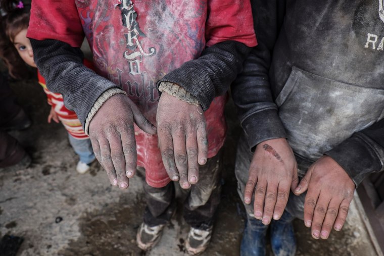 From left, Syrian refugees Hussein, 8, and Mahmoud, 12, show the condition of hands after working in an auto garage where they sand down and weld old cars 12 hours a day.