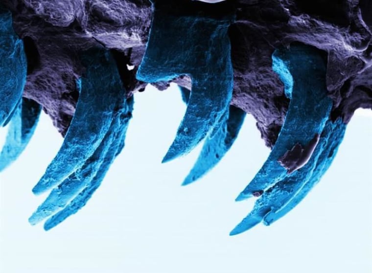 Image: Limpet teeth