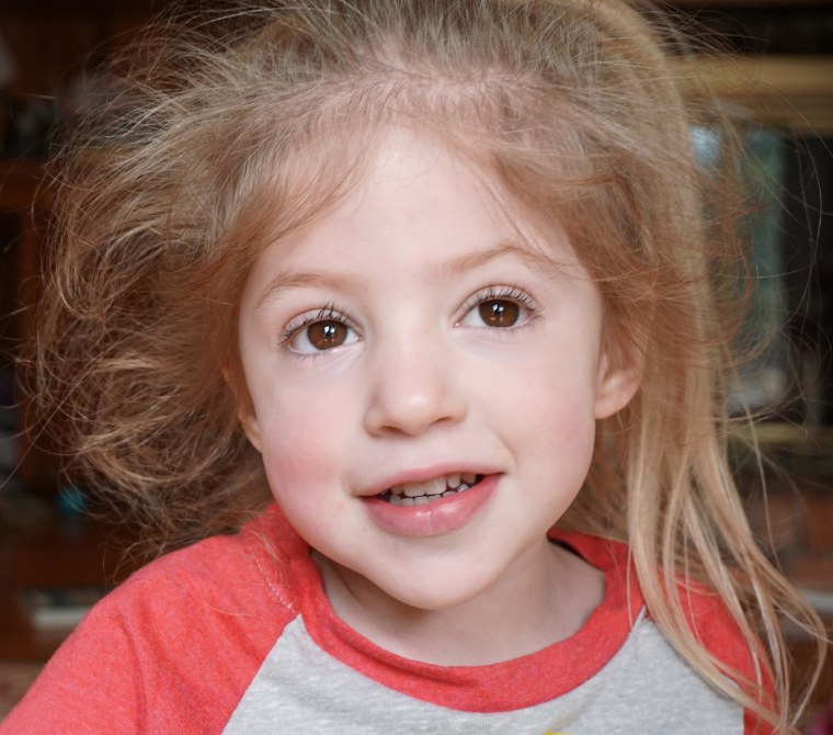 Eliza O'Neill has Sanfilippo syndrome, which occurs in one in 70,000 births.