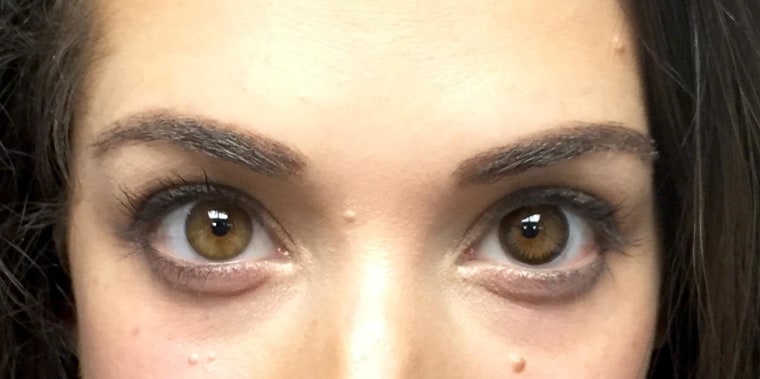 Can you spot the difference? My left eye is natural while my right eye is wearing the limbal ring-enhancing contact lens.