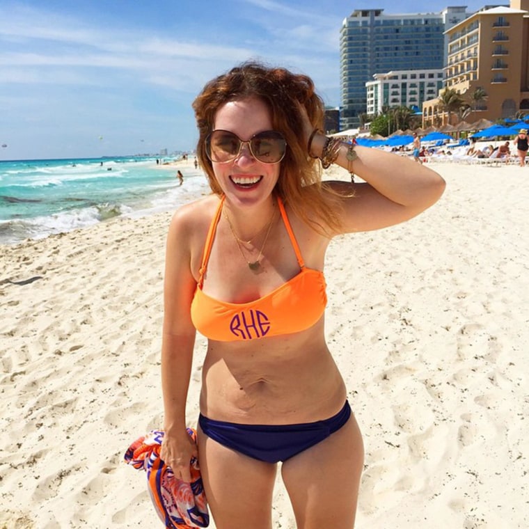 Nude Beach Rimjob - Mom flaunts flab and stretch marks in viral bikini photo
