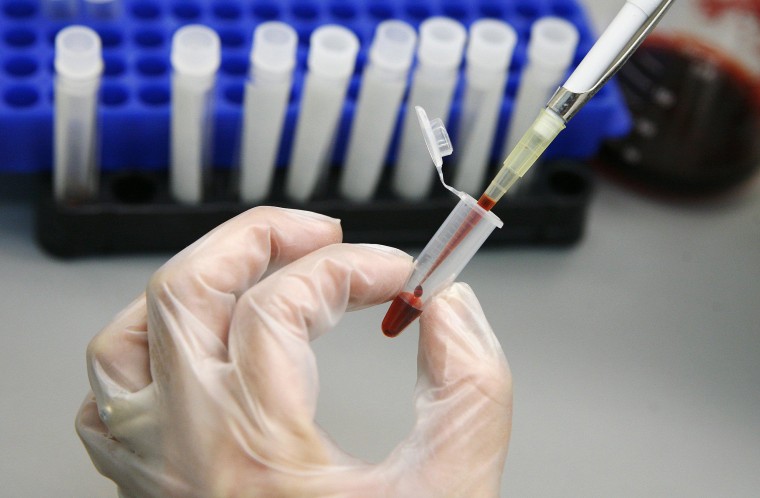 Image: A laboratory technician examines blood samples for HIV/AIDS in a public hospital in Valparaiso city