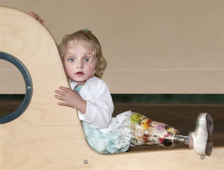 With her stylish leg in full swing, Baylee climbs the hospital lobby play structure before her prosthetic appointment.