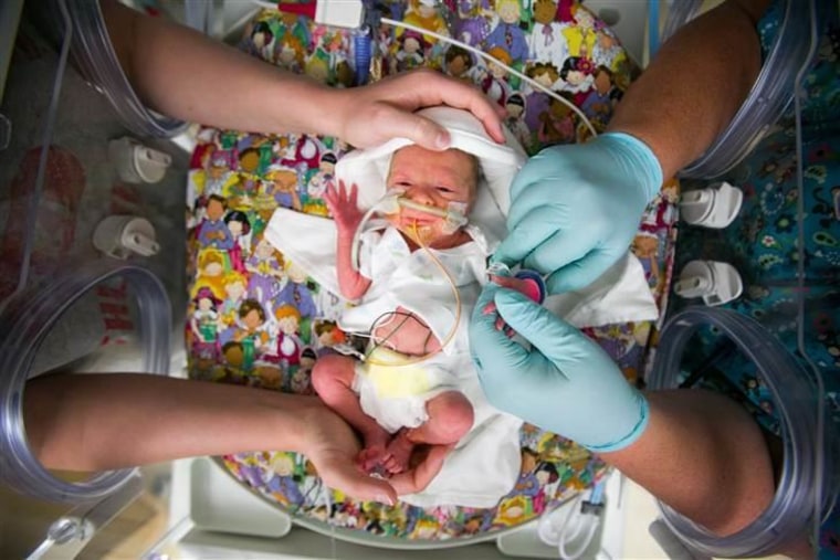 Samantha Klein gets help from a nurse as her son Liam enjoys a bath in the NICU. Born prematurely with kidney and autoimmune issues, Liam is now thriving.