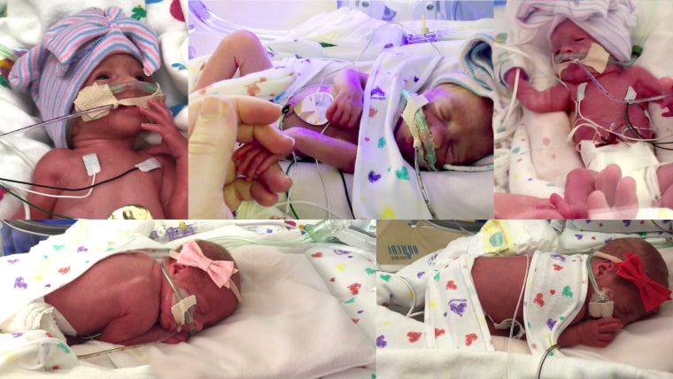 First-ever all female quintuplets born in the United States