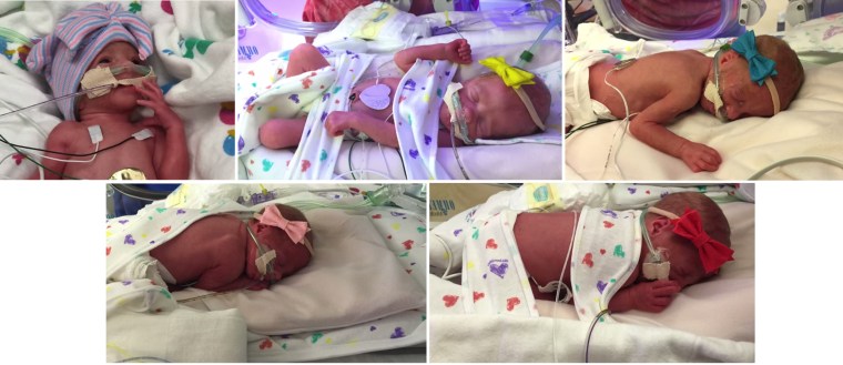 The first-ever set of all female quintuplets born in the United States were delivered in Houston last week, according to the Women's Hospital of Texas. It was the first set of all female quintuplets since 1969 in the world.
