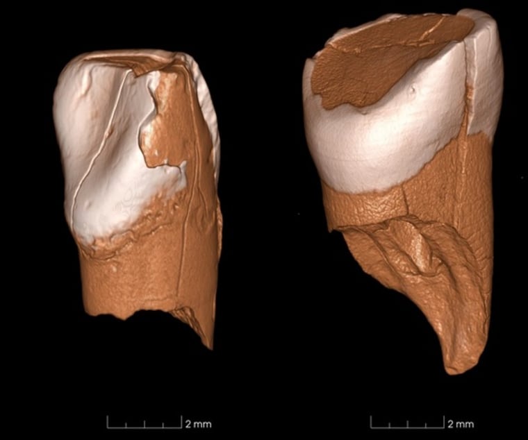 Image: Ancient teeth