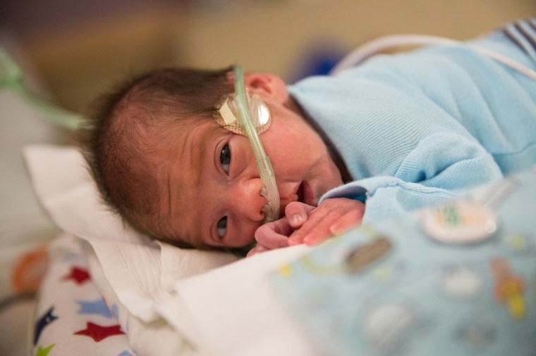 Angel Perez's miracle birth comes 54 days after his mother suffered a catastrophic catastrophic intracranial hemorrhage, a brain bleed that left her brain dead.