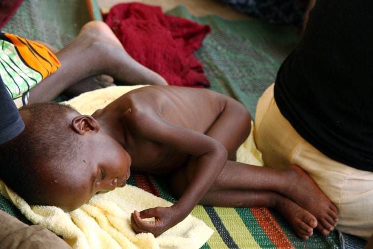 Image: A malnourished child rescued by Nigerian soldiers from the Islamist militants Boko Haram