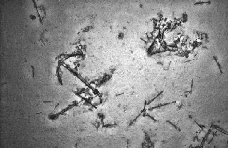 Image: Anchor from shipwreck in Indian Ocean