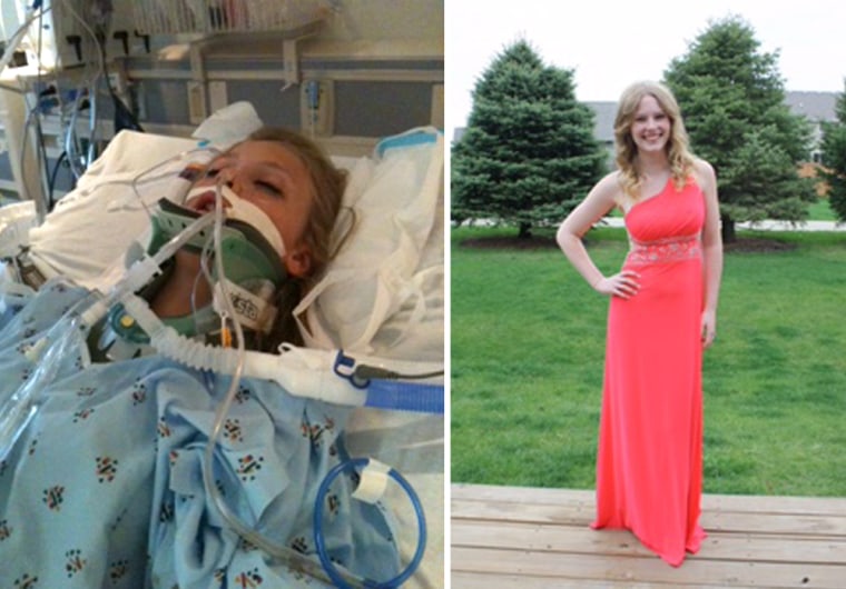 Taylor Hale, seen the day after her accident in September 2011, was in the hospital for six weeks. Hale, now 17, is seen before her high school prom. She was not expected to ever be able to walk again.