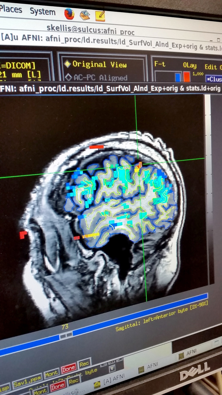 Image: brain fMRI scan