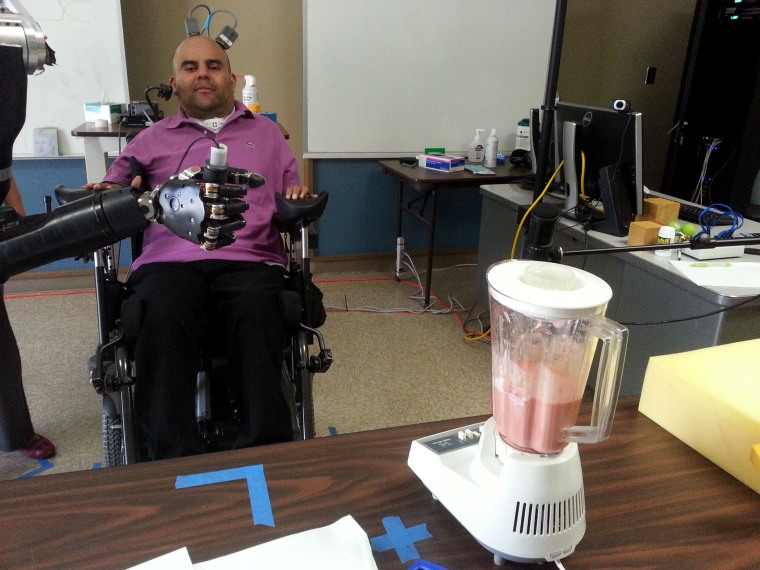 Image: First person to receive a neural prosthetic device implant