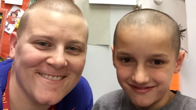 Teacher shaves head to support student