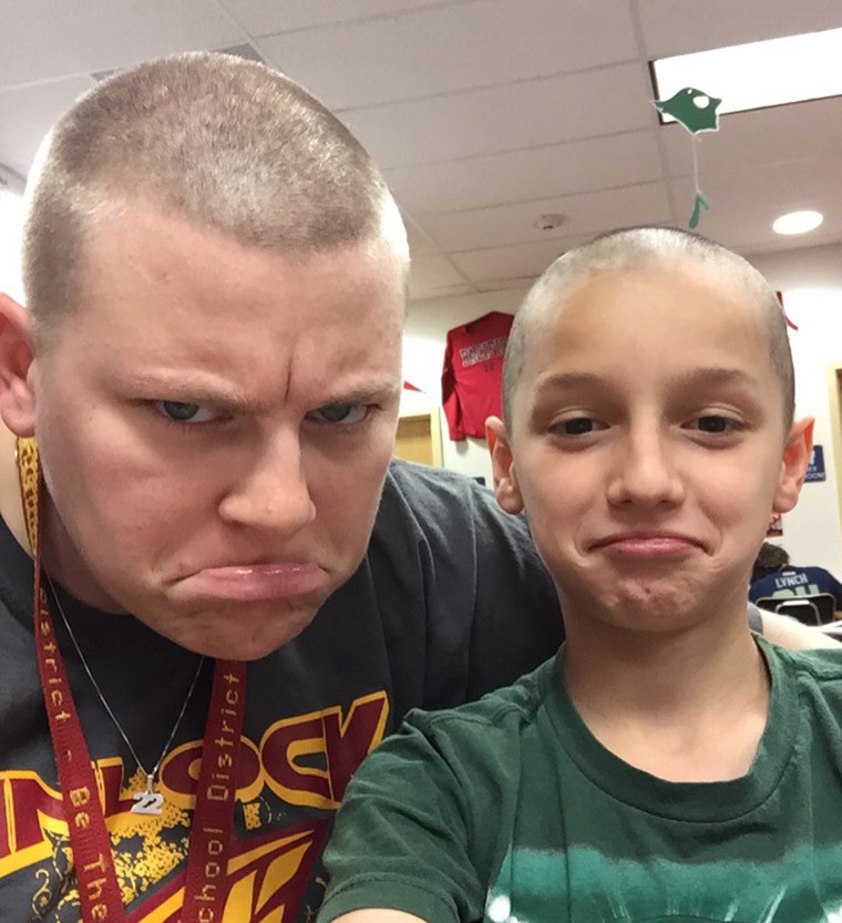 Teacher shaves head to support student