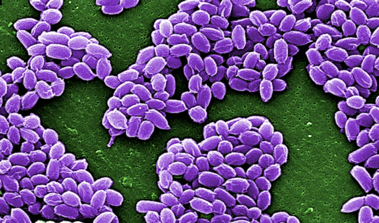 Spores from the Sterne strain of anthrax bacteria (Bacillus anthracis) are pictured in this handout scanning electron micrograph (SEM) obtained by Reuters May 28, 2015. The U.S. military mistakenly sent live anthrax bacteria to laboratories in nine U.S. states and a U.S. air base in South Korea, after apparently failing to properly inactivate the bacteria last year, U.S. officials said on May 27, 2015. 