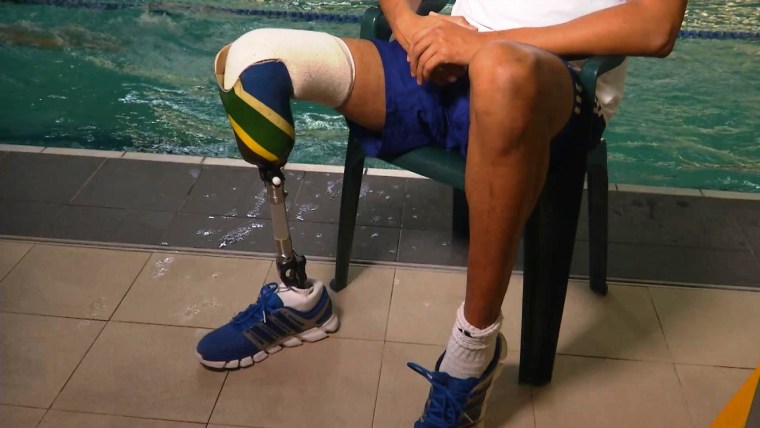 Image: Hassiem's leg