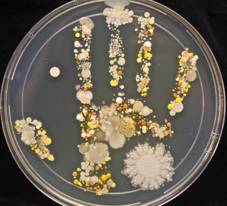 The 8-year-old boy had been playing outside before he pressed his hand into the Petri dish.