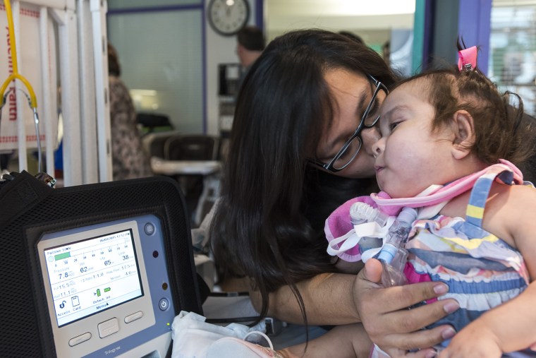 Formerly conjoined twin goes home after successful separation surgery