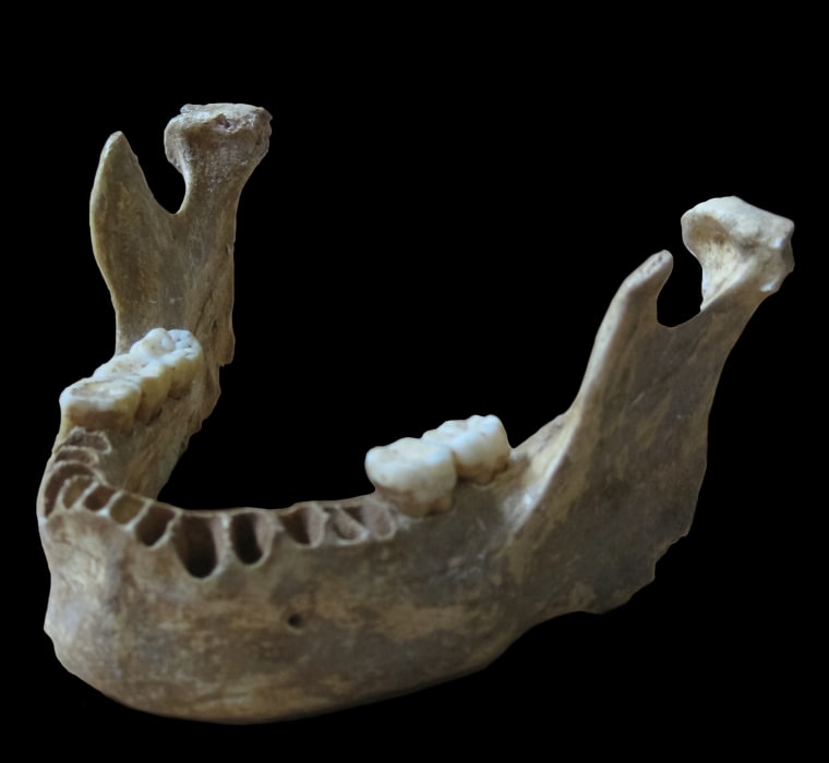 Image: Jawbone