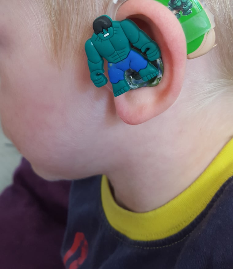 Sarah Ivermee, the creator of Lugs hearing-aid decals, is the mother of Freddie Ivermee, a boy born whose childhood battle with congenital cytomegalovirus "left him profoundly deaf in one ear and moderately to severely deaf in the other," according to the business' website.