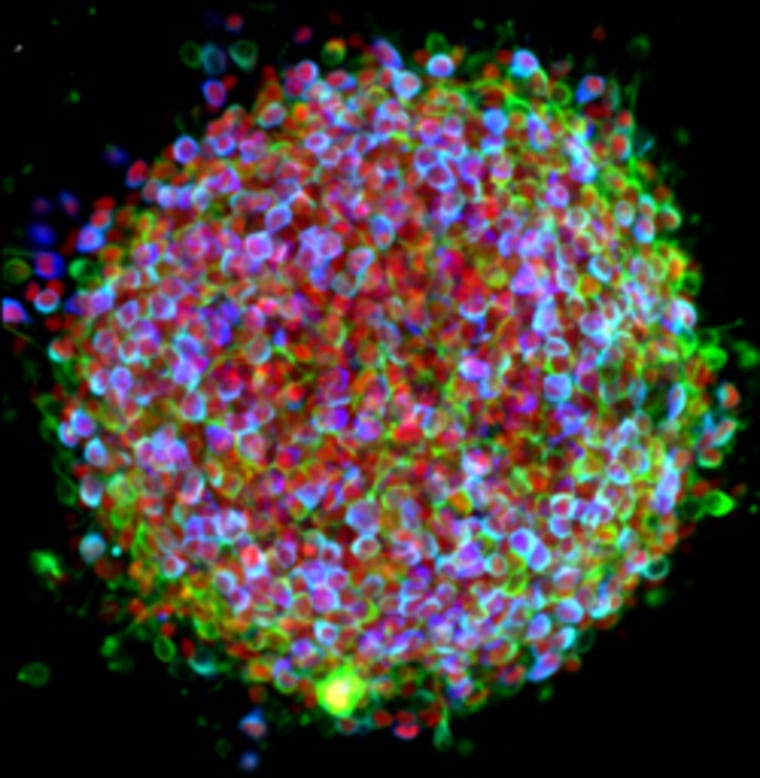 A cluster of induced pluripotent stem cells (iPS cells)