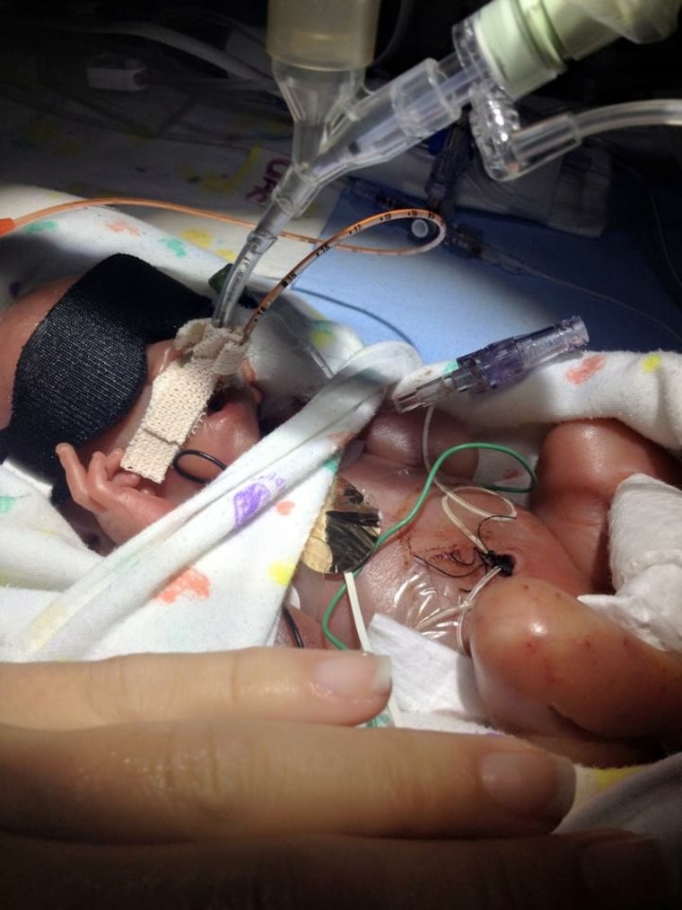 Baby in the NICU