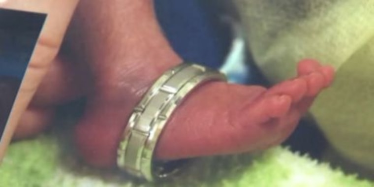 Trevor's foot was so tiny that his dad Bo Frolek was able to slip his wedding ring over it.