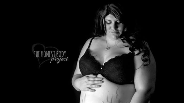 Brittany Dykstra, pregnant woman who was body shamed. The Honest Body Project