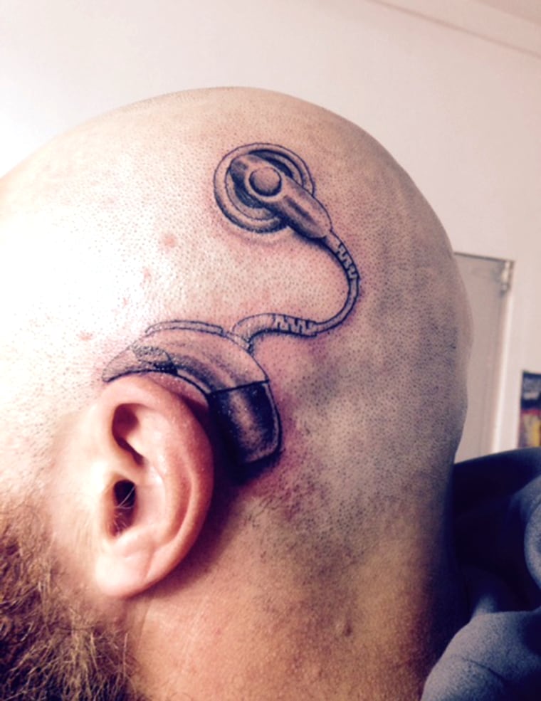 New Zealand dad gets tattoo of a cochlear implant, to match the one his daughter was about get.