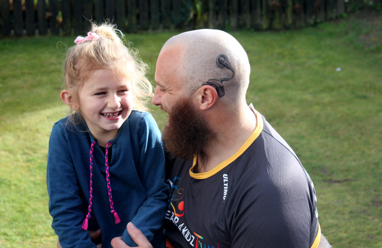 Dad's cochlear implant tattoo matches the real one worn by daughter.