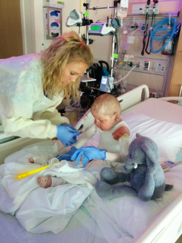 Anton, who was abandoned at a Russian hospital, underwent a bone marrow transplant at the University of Minnesota Masonic Children's Hospital.