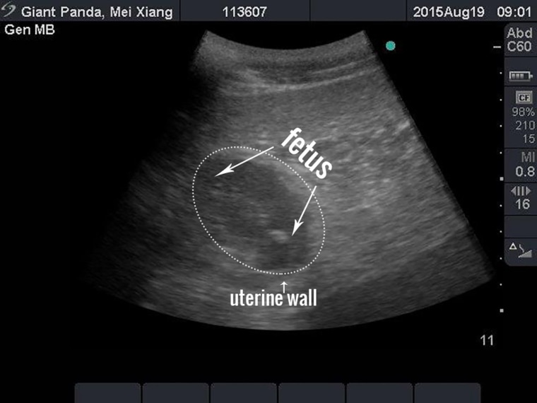 Image: Handout photograph shows an ultrasound image of Smithsonian National Zoo giant panda Mei Xiang