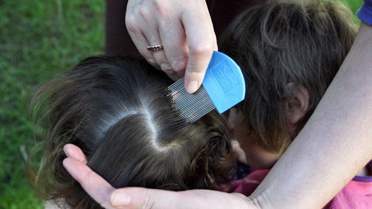 Super Strains Of Lice Spread To 25 States Report Finds 