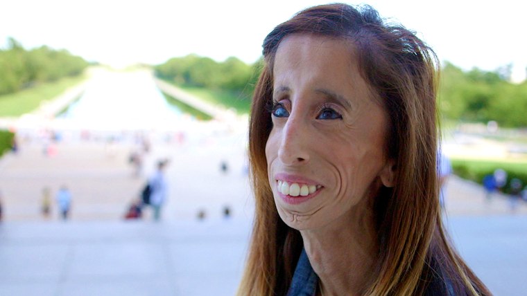 Bullying victim turned global motivational speaker, Lizzie Velasquez