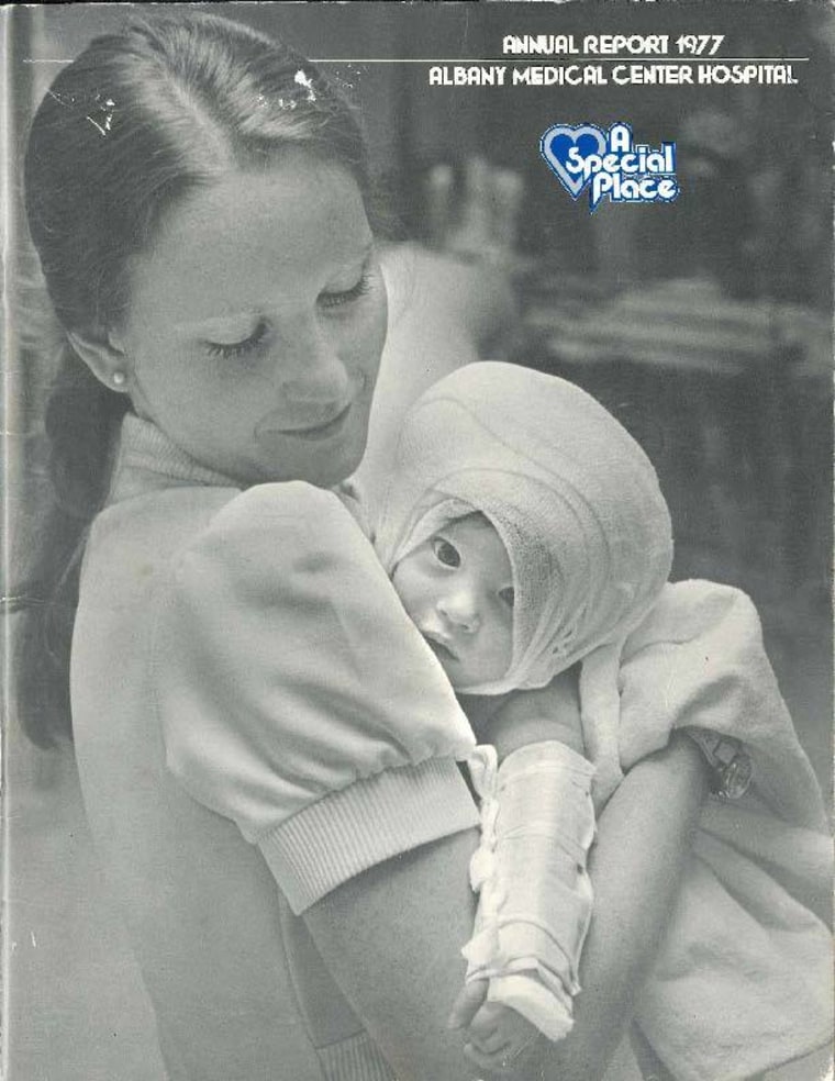 Amanda Scarpinati as a 3-month-old baby held by nurse Sue Berger at the Albany Medical Center after suffering burns.