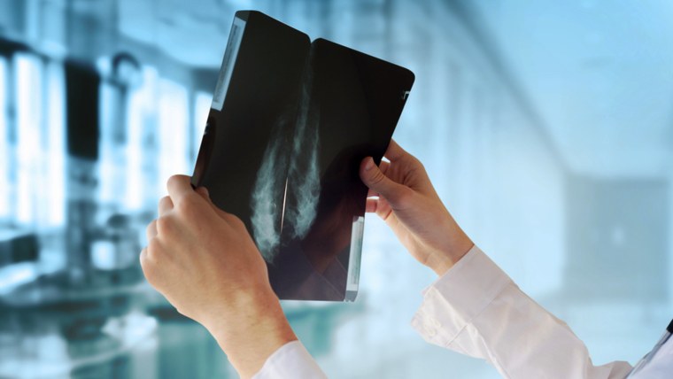 Women in their 40s are advised to talk with their doctors about mammography's benefits and potential harms.